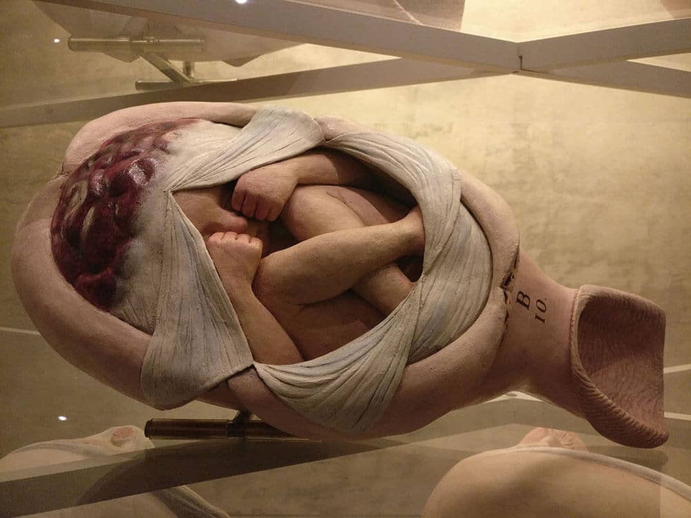 Palazzo Poggi Anatomical Wax