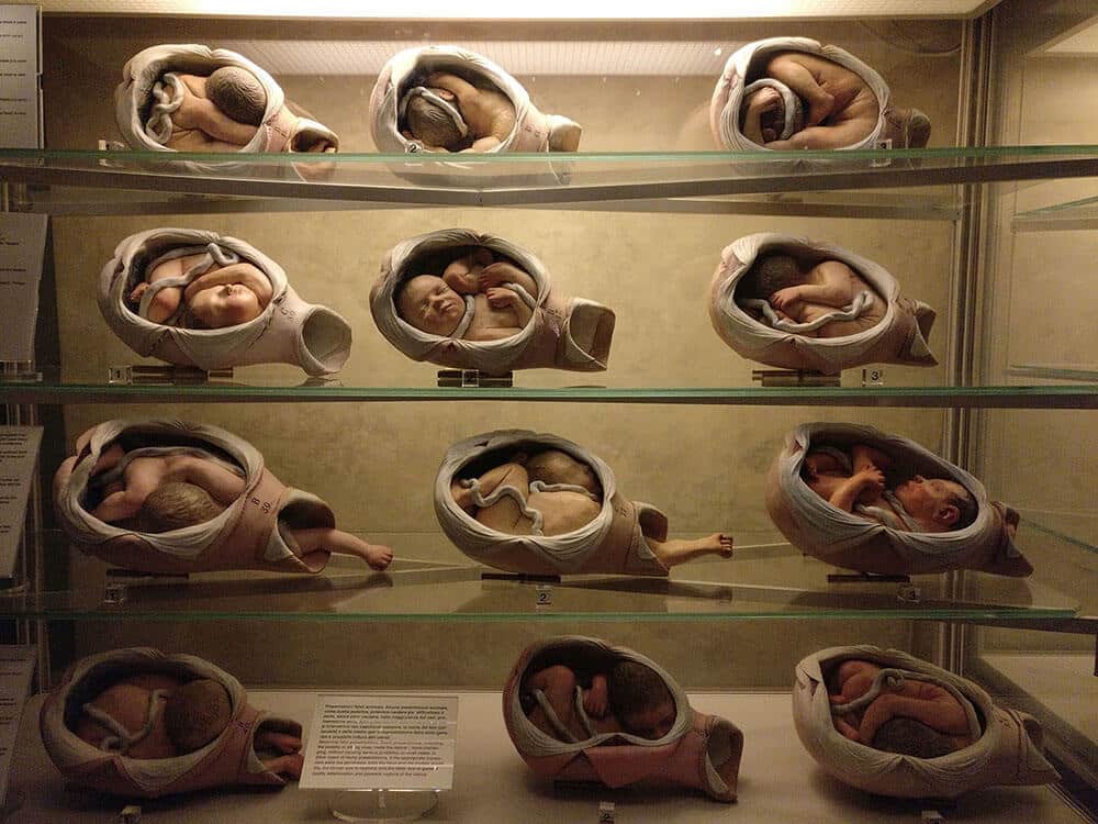 Palazzo Poggi Anatomical Wax